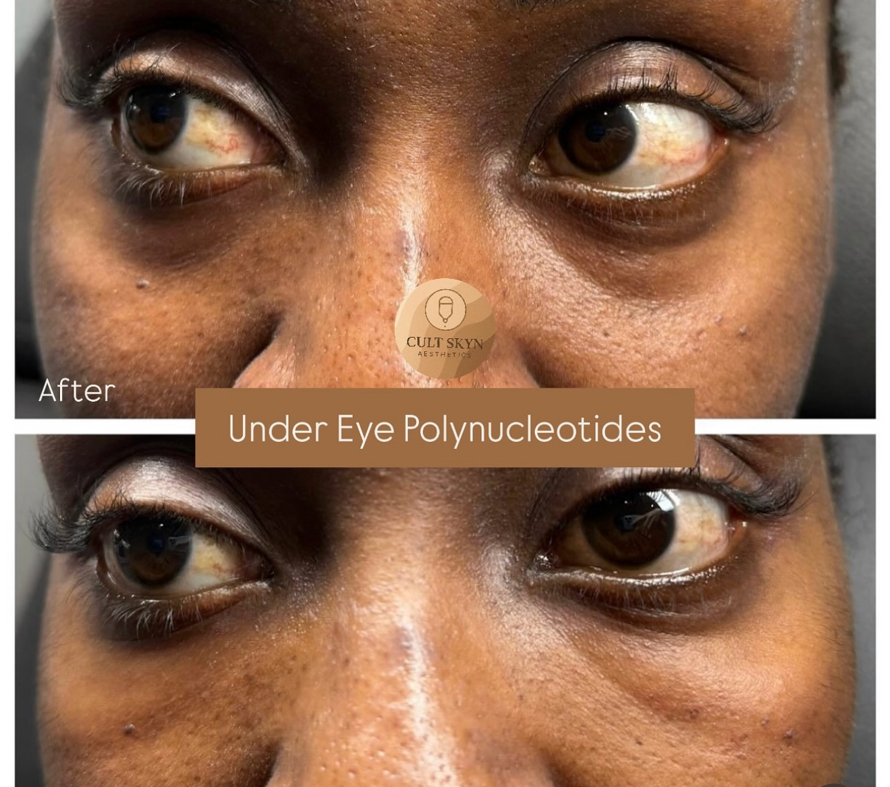 Under-Eye Polynucleotides